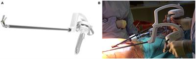 Surgeon-Powered Robotics in Thoracic Surgery; An Era of Surgical Innovation and Its Benefits for the Patient and Beyond